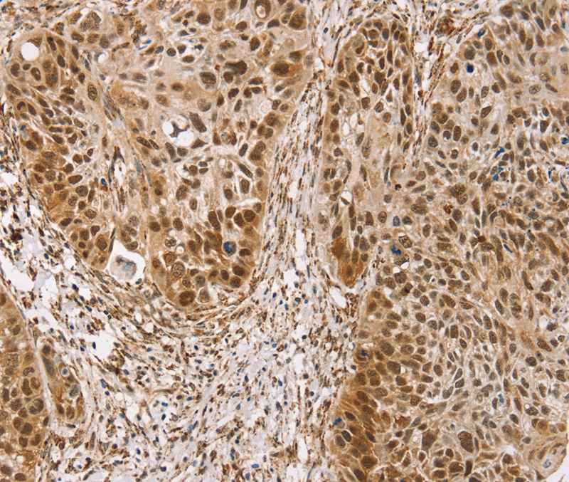 TAF12 Antibody