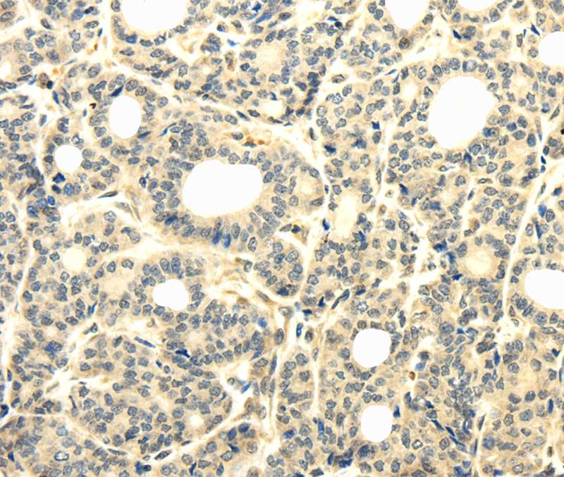 TBC1D22A Antibody