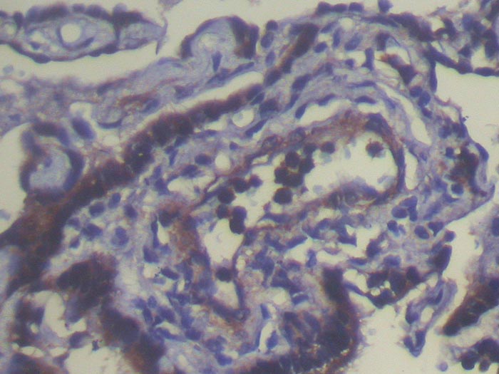 THAP4 Antibody