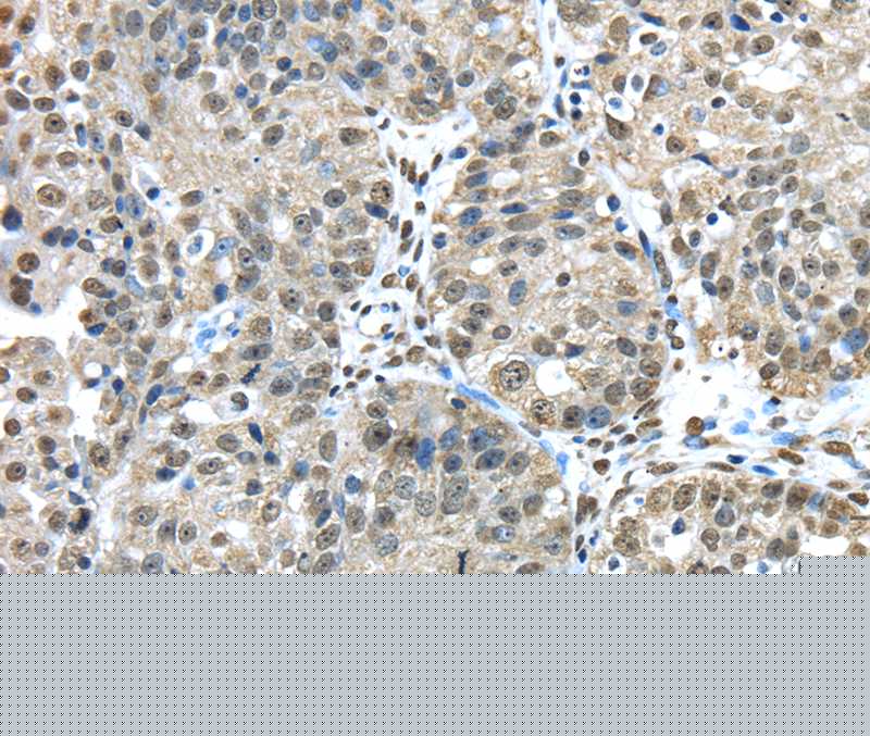 FUS Antibody