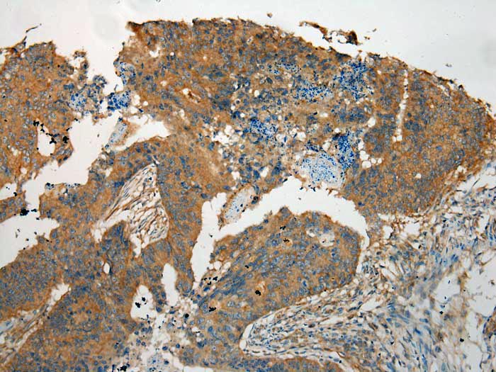 TMPRSS11E Antibody
