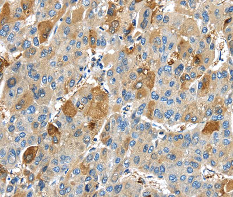 TNFAIP2 Antibody