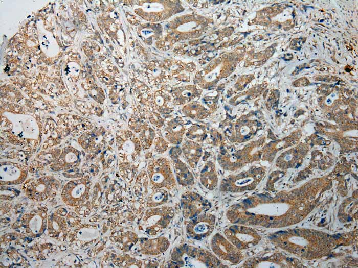 TPSB2 Antibody