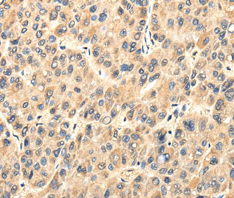 TWIST2 Antibody