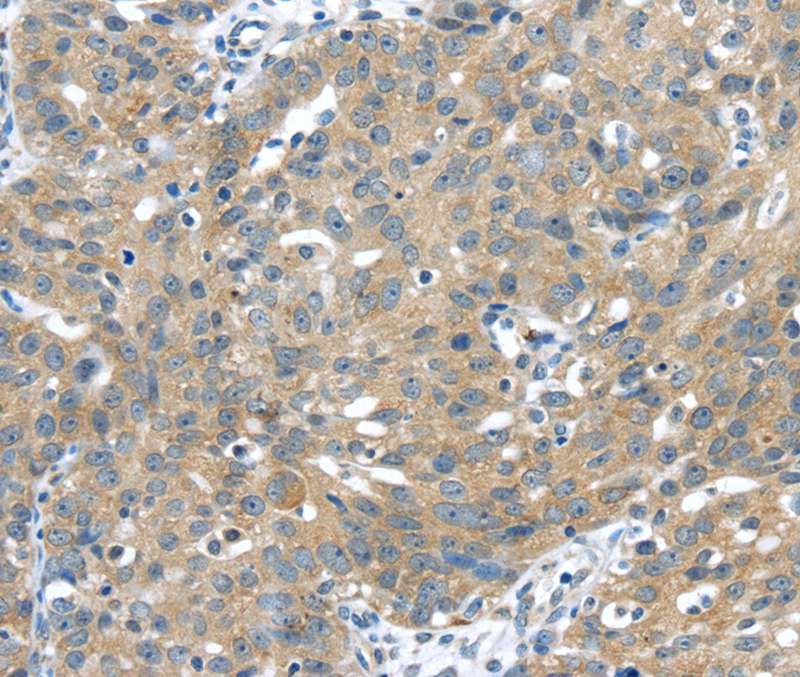 UCHL3 Antibody