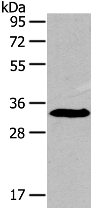 IGFBP3 Antibody