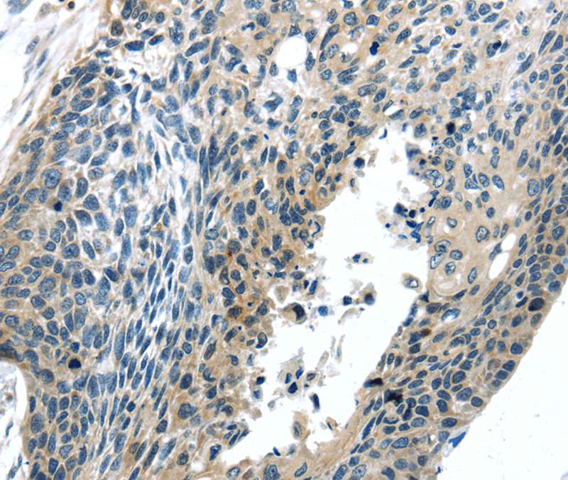 BOK(BH3 domain) Antibody