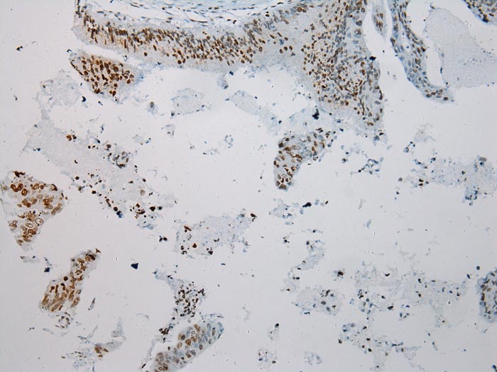 S1PR2 Antibody