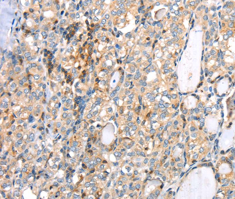 MAGEB2 Antibody