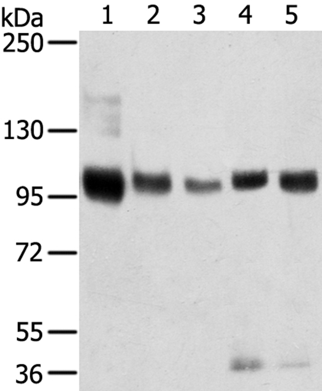 SORT1 Antibody