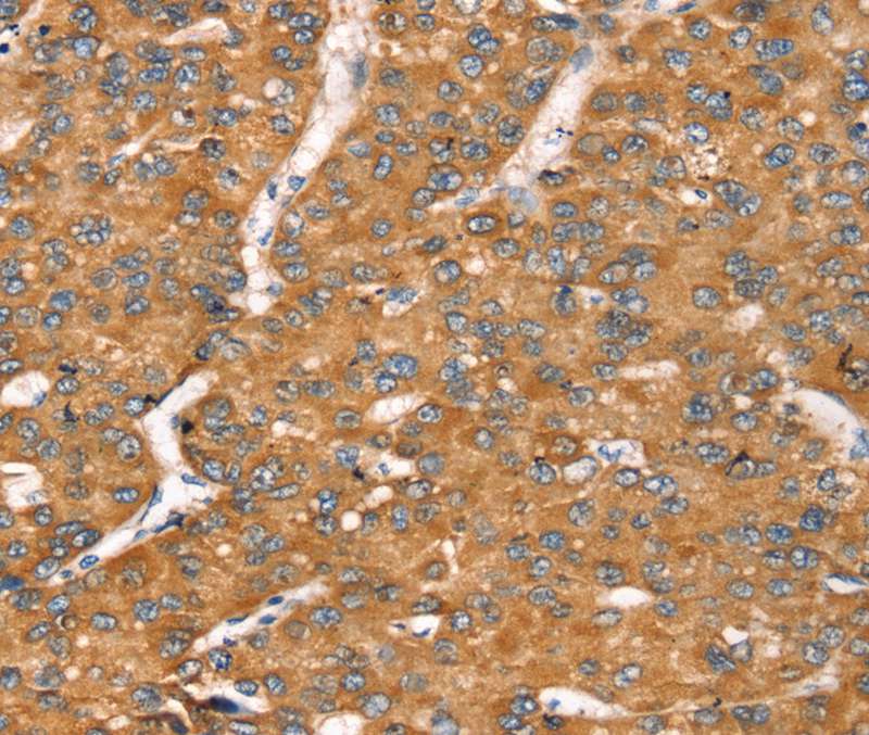 TGFB2 Antibody