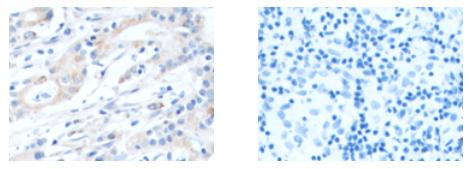 THBS2 Antibody