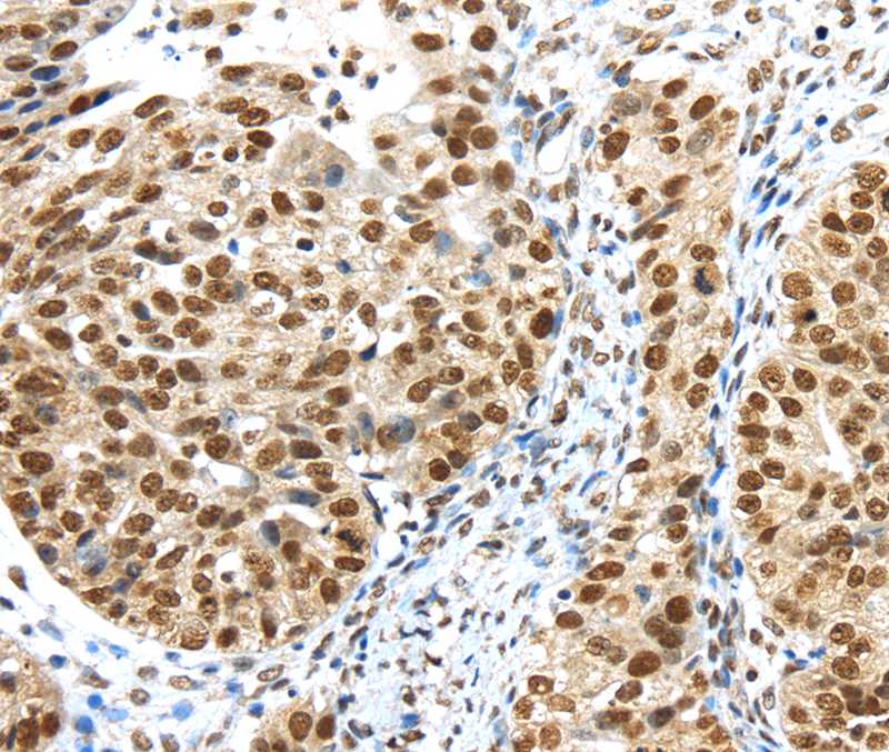 TRIM33 Antibody