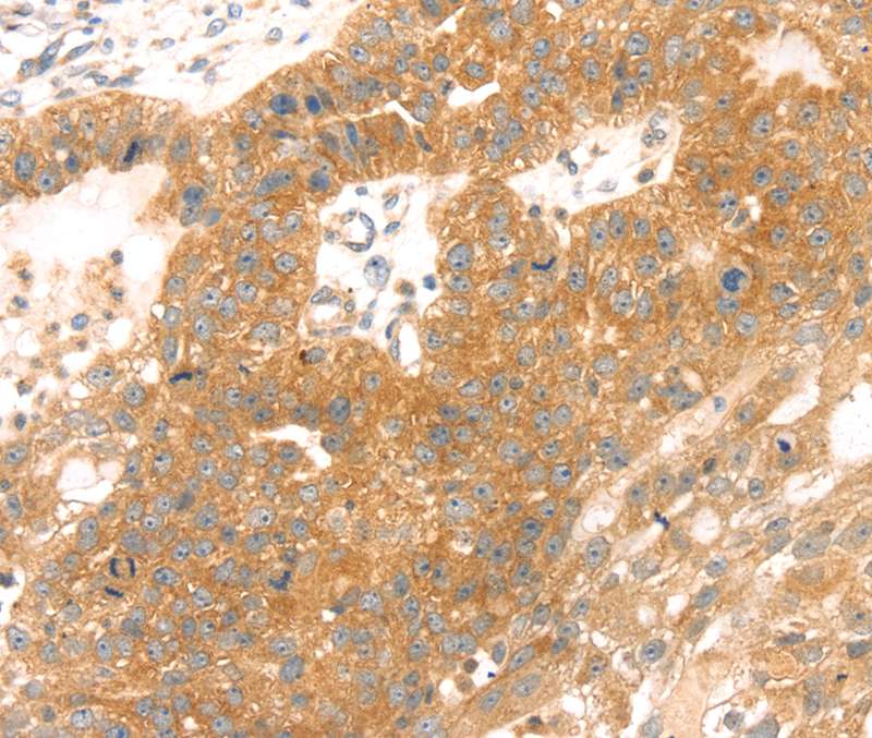 TMEFF2 Antibody
