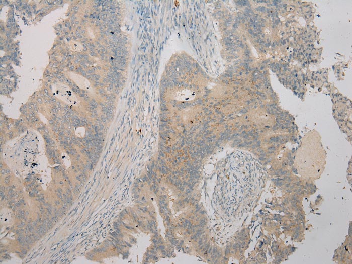 TSPY1 Antibody
