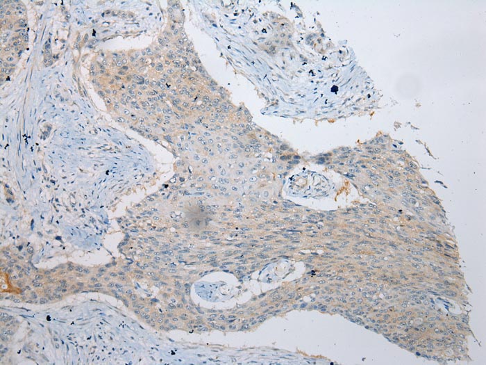 VPS4A Antibody