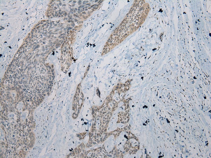 IL-20 Antibody