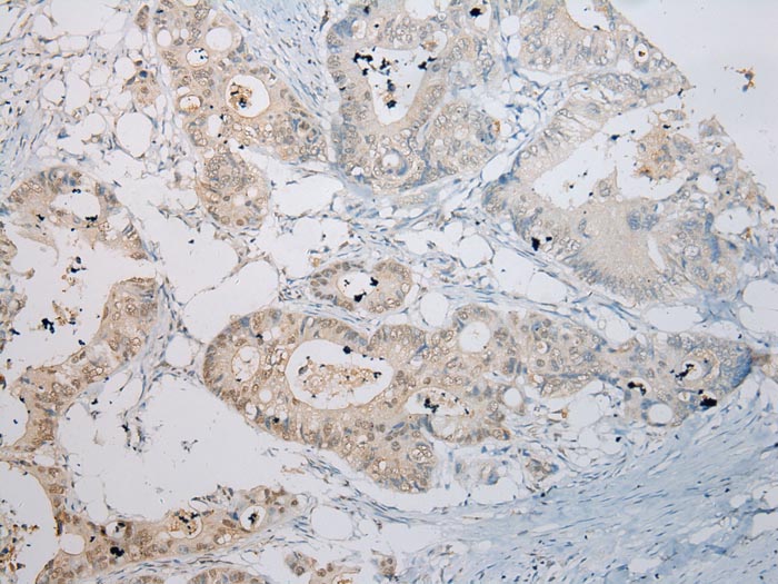 RASSF3 Antibody