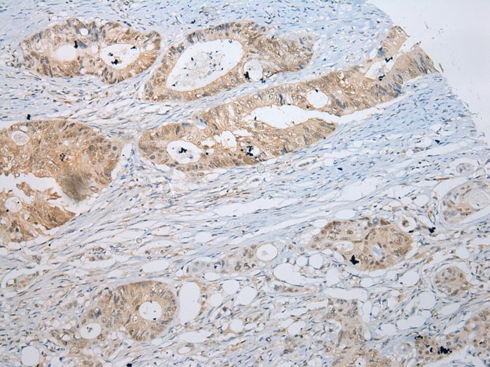SSBP4 Antibody