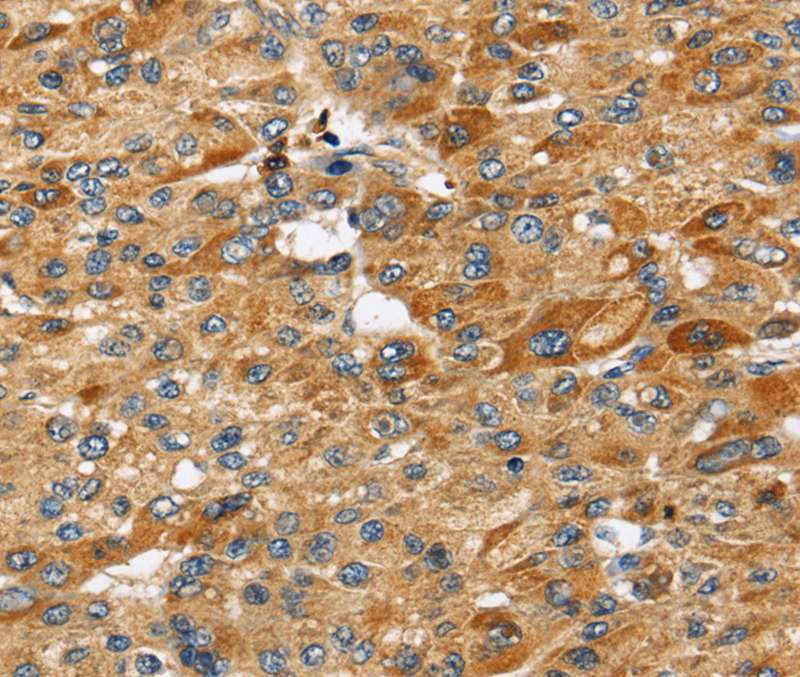 STC2 Antibody