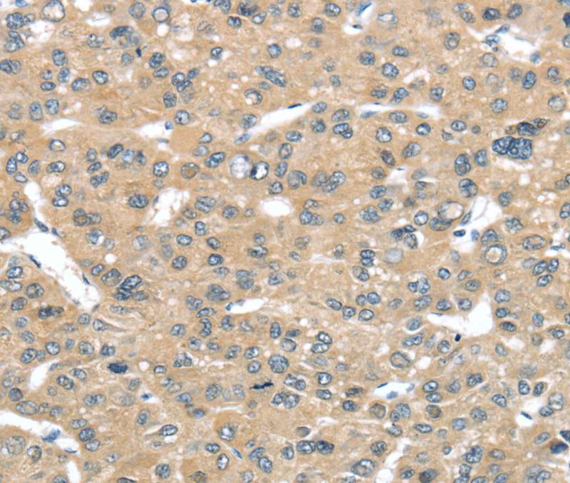 TUSC2 Antibody