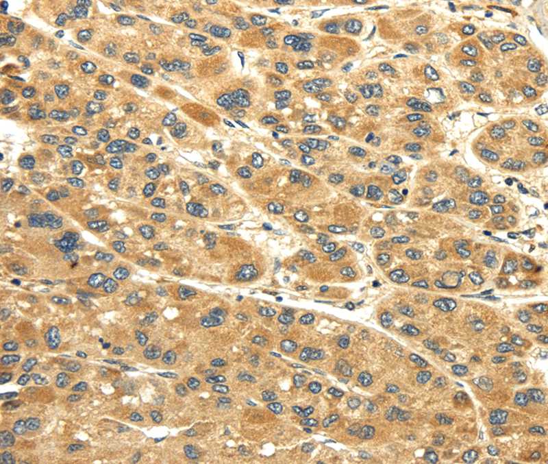 UACA Antibody