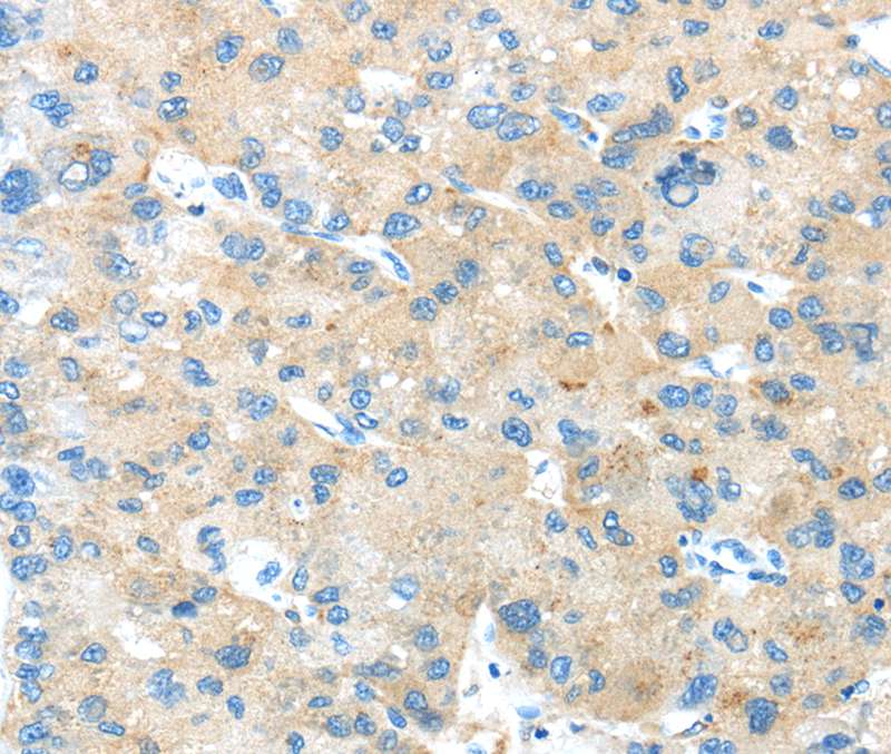 ANGPTL5 Antibody