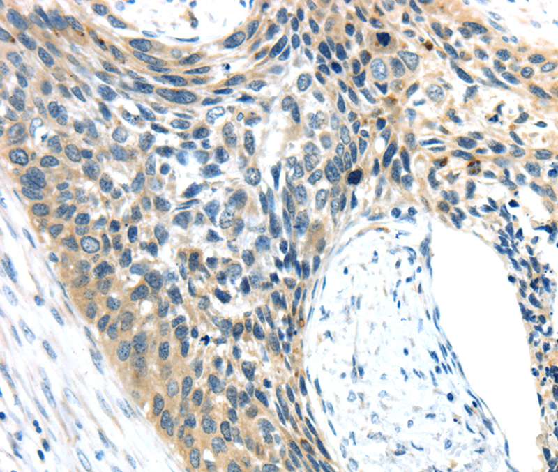 AEBP1 Antibody