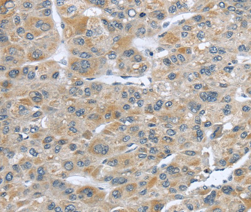 CFAP45 Antibody