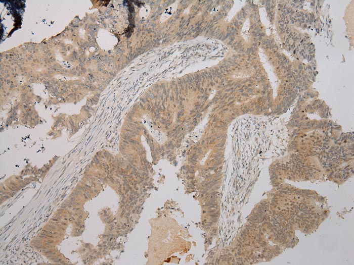 TPST2 Antibody