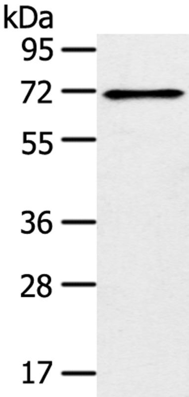 TRIM47 Antibody