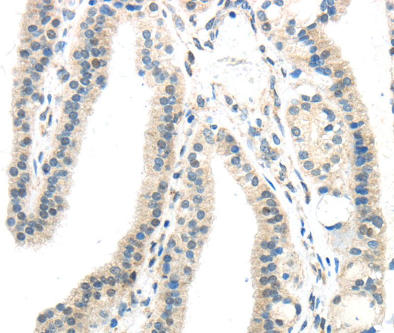 IL12A Antibody