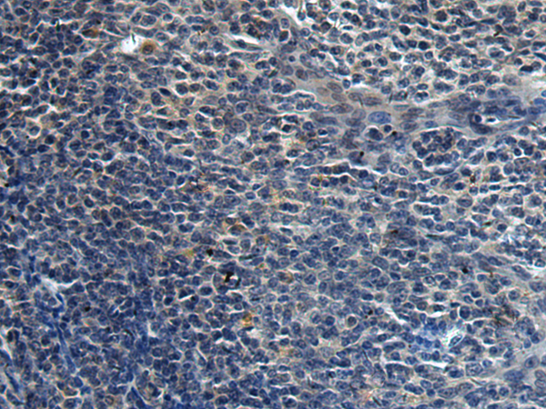 HAUS6 antibody