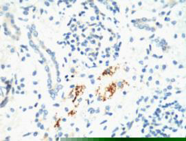 Kif 7 Monoclonal Antibody