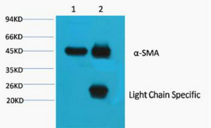 Cleaved-Plasma Kallikrein HC (R390) Polyclonal Antibody