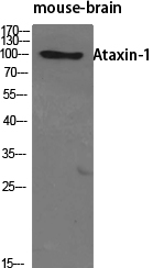 Ataxin Polyclonal Antibody