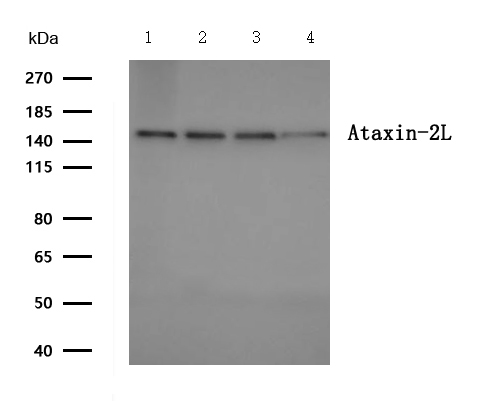 Ataxin-2L Polyclonal Antibody