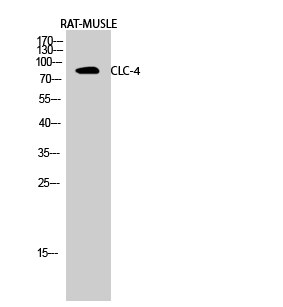 CLC-4 Polyclonal Antibody