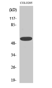 CLCC1 Polyclonal Antibody