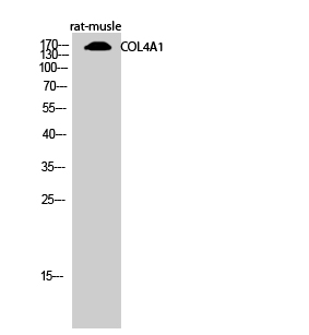 COL4A1 Polyclonal Antibody