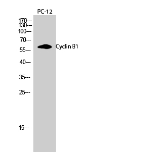 Cyclin B1 Polyclonal Antibody