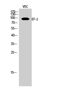 EF-2 Polyclonal Antibody