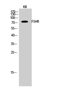 FSHR Polyclonal Antibody