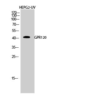 GPR120 Polyclonal Antibody