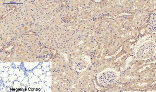 ILβ Polyclonal Antibody