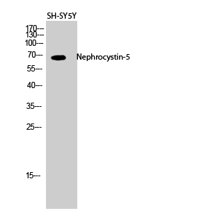Nephrocystin-5 Polyclonal Antibody