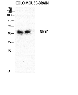 NKR Polyclonal Antibody
