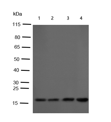 p16 Polyclonal Antibody