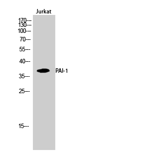 PAI Polyclonal Antibody