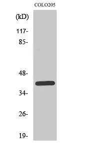 PKAα/β/γ cat Polyclonal Antibody